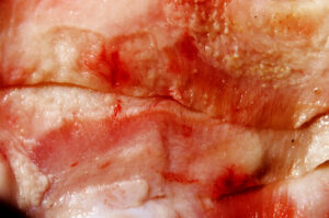 shutterstock_35200615-300x199 Fibroblasten en macrofagen werken nauwer samen dan gedacht